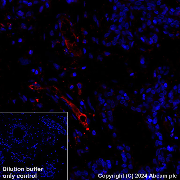 Immunohistochemistry (Formalin/PFA-fixed paraffin-embedded sections) - Alexa Fluor® 647 Anti-LRG1/LRG antibody [EPR12362] (AB318234)