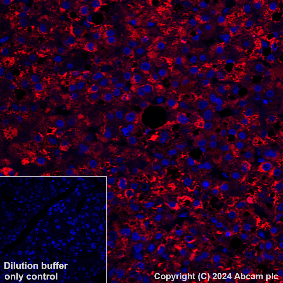 Immunohistochemistry (Formalin/PFA-fixed paraffin-embedded sections) - Alexa Fluor® 647 Anti-LRG1/LRG antibody [EPR12362] (AB318234)