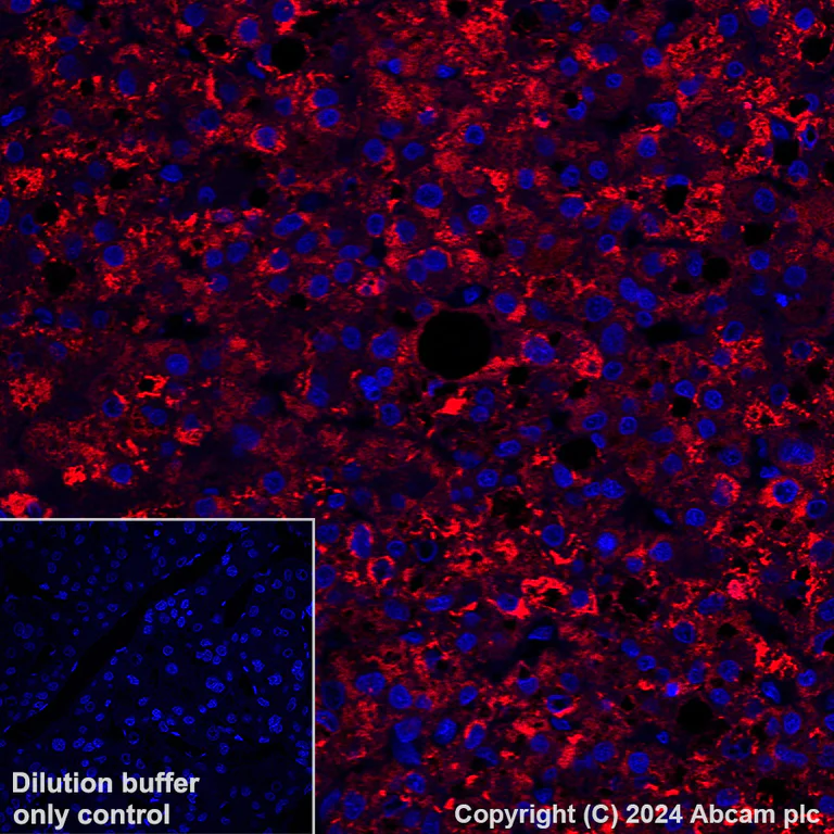 Immunohistochemistry (Formalin/PFA-fixed paraffin-embedded sections) - Alexa Fluor® 647 Anti-LRG1/LRG antibody [EPR12362] (AB318234)