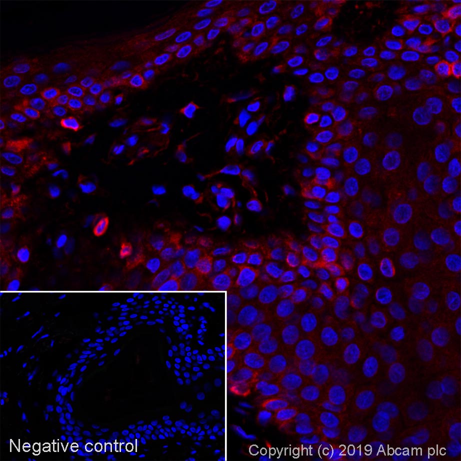 Immunohistochemistry (Formalin/PFA-fixed paraffin-embedded sections) - Alexa Fluor® 647 Anti-Lumican antibody [EPR8898(2)] (AB252011)
