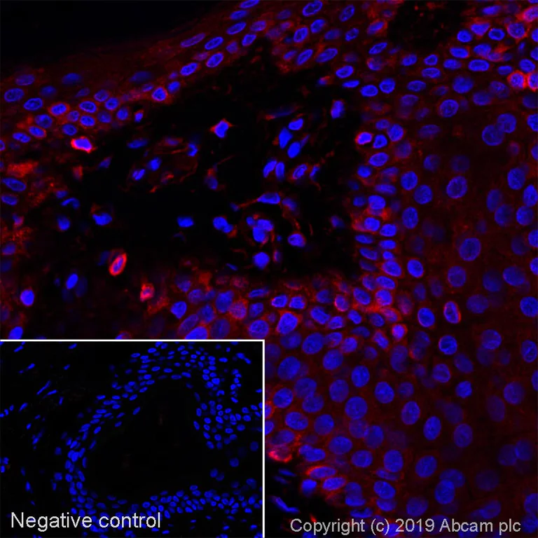 Immunohistochemistry (Formalin/PFA-fixed paraffin-embedded sections) - Alexa Fluor® 647 Anti-Lumican antibody [EPR8898(2)] (AB252011)