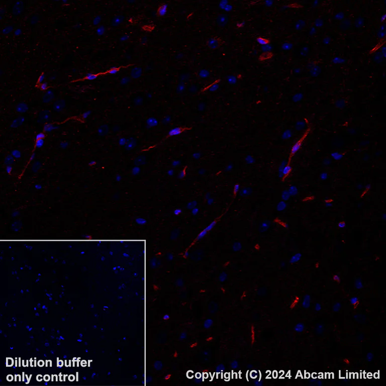 Immunohistochemistry (Formalin/PFA-fixed paraffin-embedded sections) - Alexa Fluor® 647 Anti-Ly6c antibody [EPR27220-23] (AB319187)