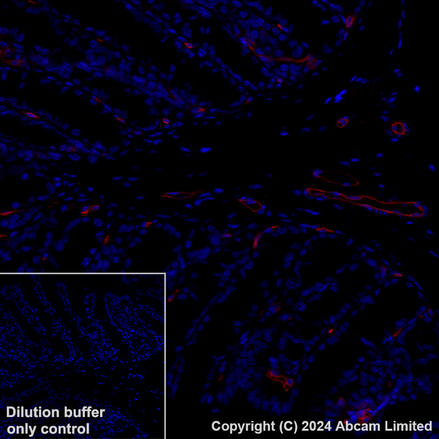 Immunohistochemistry (Formalin/PFA-fixed paraffin-embedded sections) - Alexa Fluor® 647 Anti-Ly6c antibody [EPR27220-23] (AB319187)