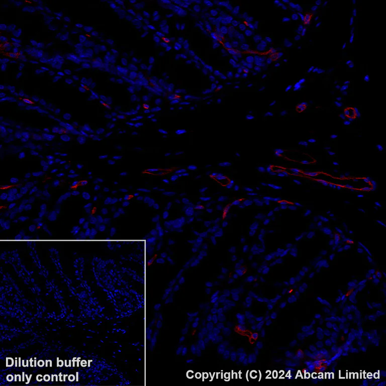 Immunohistochemistry (Formalin/PFA-fixed paraffin-embedded sections) - Alexa Fluor® 647 Anti-Ly6c antibody [EPR27220-23] (AB319187)