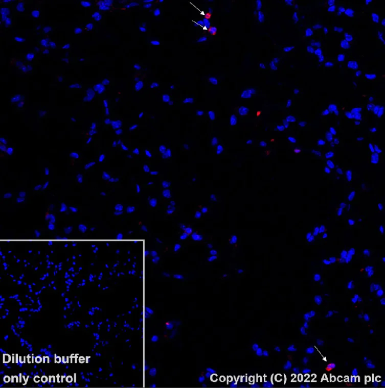 Immunohistochemistry (Formalin/PFA-fixed paraffin-embedded sections) - Alexa Fluor® 647 Anti-Ly6g antibody [EPR22909-135] (AB303467)