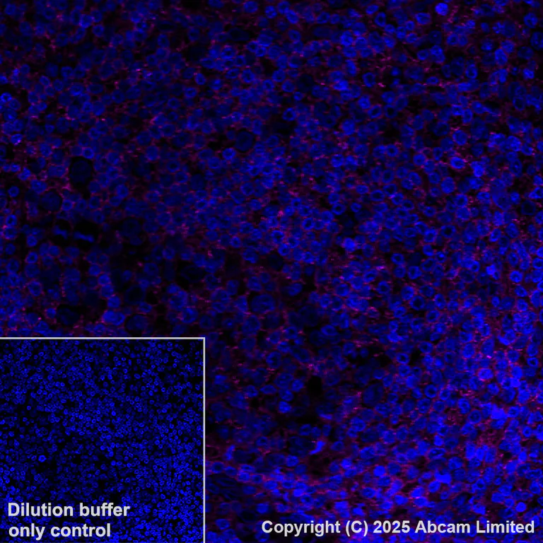 Immunohistochemistry (Formalin/PFA-fixed paraffin-embedded sections) - Alexa Fluor® 647 Anti-Lyn antibody [EPR28556-68] (AB325379)