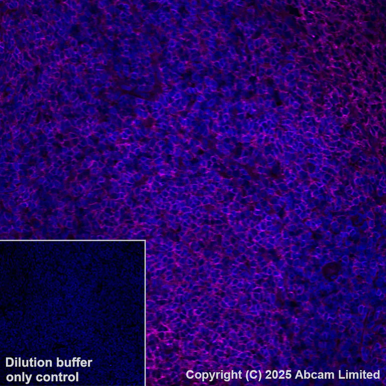 Immunohistochemistry (Formalin/PFA-fixed paraffin-embedded sections) - Alexa Fluor® 647 Anti-Lyn antibody [EPR28556-68] (AB325379)