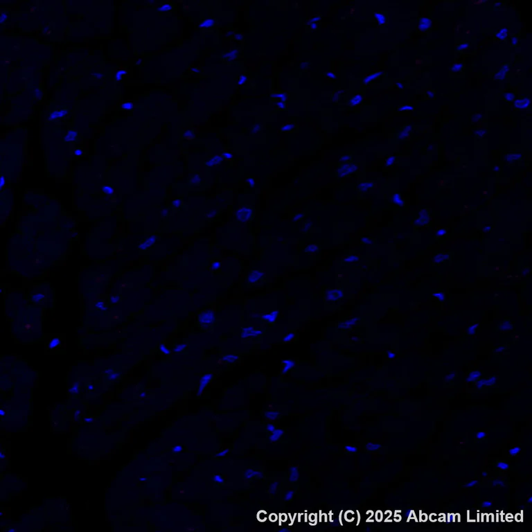 Immunohistochemistry (Formalin/PFA-fixed paraffin-embedded sections) - Alexa Fluor® 647 Anti-Lyn antibody [EPR28556-68] (AB325379)