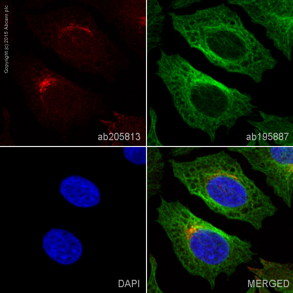 Immunocytochemistry/ Immunofluorescence - Alexa Fluor® 647 Anti-M6PR (cation independent) antibody [2G11] - Lysosome Membrane Marker (AB205813), expandable thumbnail
