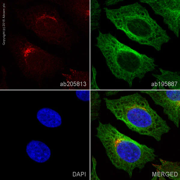 Immunocytochemistry/ Immunofluorescence - Alexa Fluor® 647 Anti-M6PR (cation independent) antibody [2G11] - Lysosome Membrane Marker (AB205813)