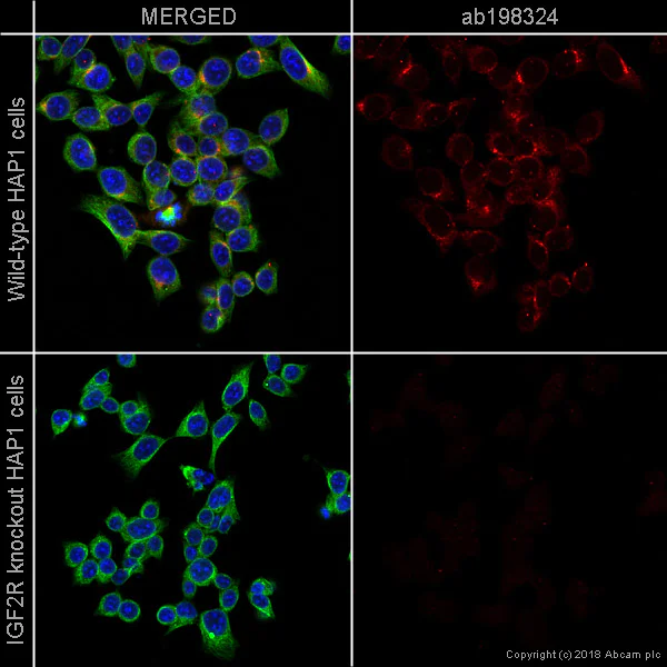 Immunocytochemistry/ Immunofluorescence - Alexa Fluor® 647 Anti-M6PR (cation independent) antibody [EPR6599] - Lysosome Membrane Marker (AB198324)