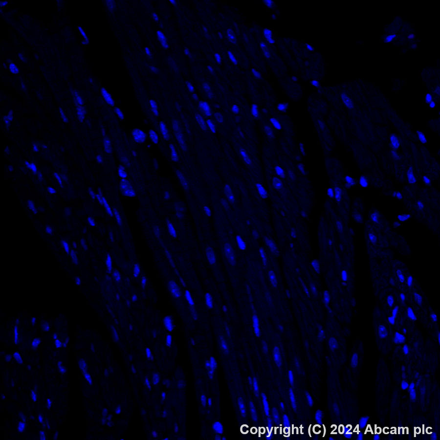 Immunohistochemistry (Formalin/PFA-fixed paraffin-embedded sections) - Alexa Fluor® 647 Anti-MAdCAM1 antibody [EPR27223-58] (AB318244)