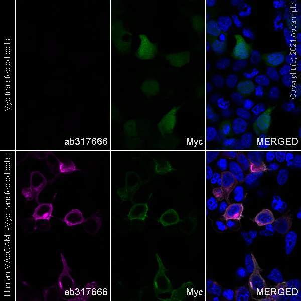 Immunocytochemistry/ Immunofluorescence - Alexa Fluor® 647 Anti-MAdCAM1 antibody [EPR27555-87] (AB317666)