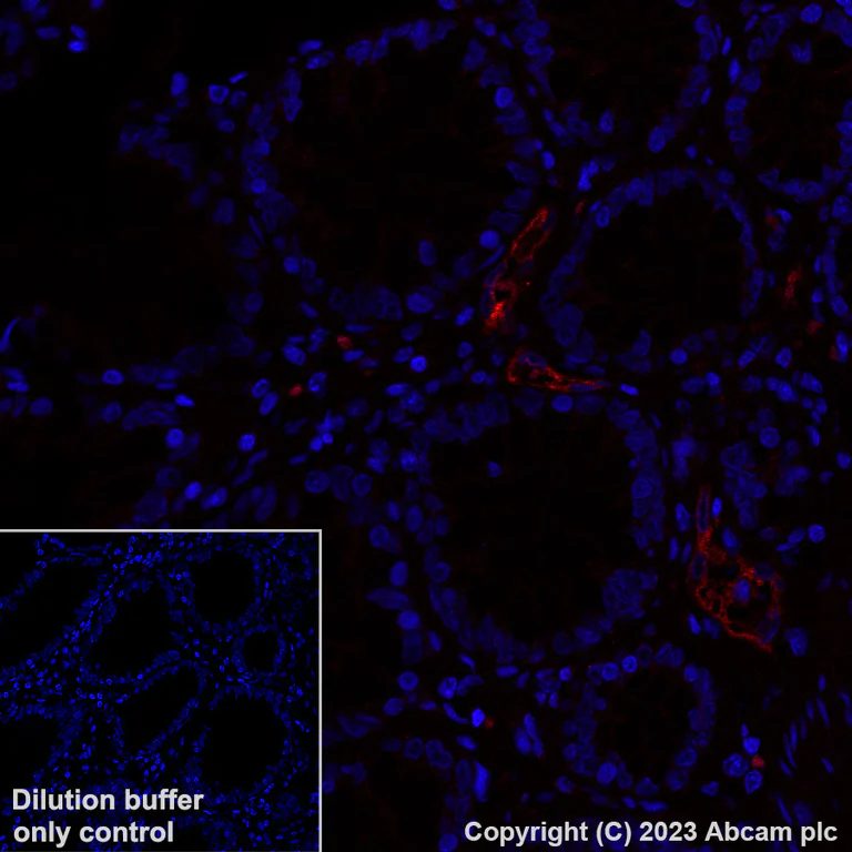 Immunohistochemistry (Formalin/PFA-fixed paraffin-embedded sections) - Alexa Fluor® 647 Anti-MAdCAM1 antibody [EPR27555-87] (AB317666)