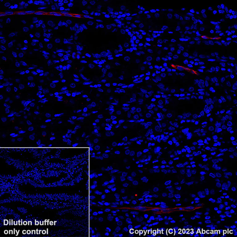 Immunohistochemistry (Formalin/PFA-fixed paraffin-embedded sections) - Alexa Fluor® 647 Anti-MAdCAM1 antibody [EPR27555-87] (AB317666)