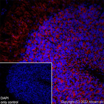 Immunohistochemistry (Formalin/PFA-fixed paraffin-embedded sections) - Alexa Fluor® 647 Anti-MAP2 antibody [EPR19691] - Neuronal Marker (AB225315), expandable thumbnail