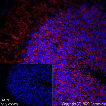 Immunohistochemistry (Formalin/PFA-fixed paraffin-embedded sections) - Alexa Fluor® 647 Anti-MAP2 antibody [EPR19691] - Neuronal Marker (AB225315)