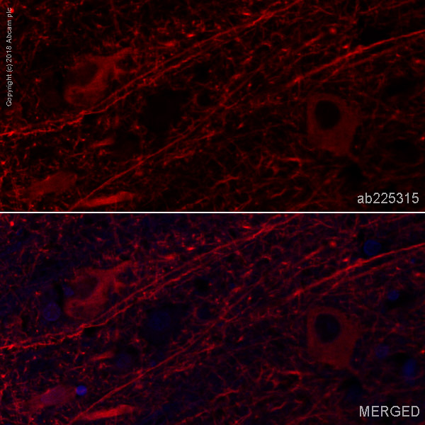 Immunohistochemistry (Formalin/PFA-fixed paraffin-embedded sections) - Alexa Fluor® 647 Anti-MAP2 antibody [EPR19691] - Neuronal Marker (AB225315), expandable thumbnail
