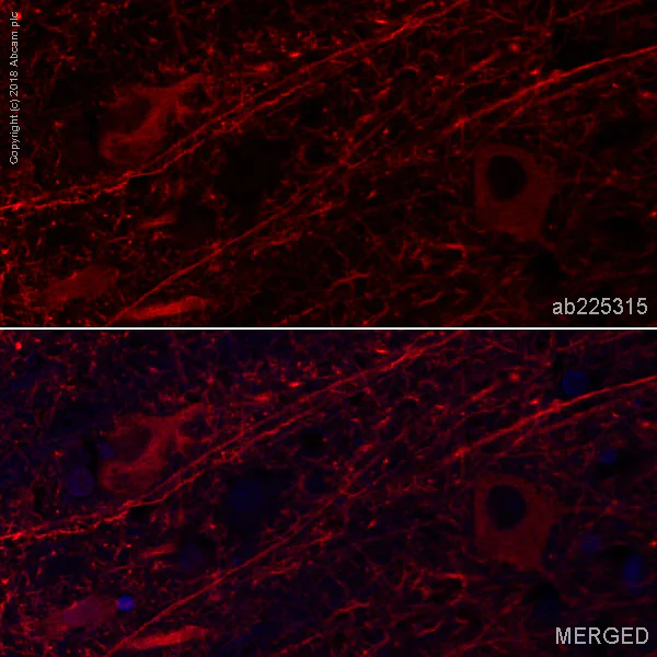 Immunohistochemistry (Formalin/PFA-fixed paraffin-embedded sections) - Alexa Fluor® 647 Anti-MAP2 antibody [EPR19691] - Neuronal Marker (AB225315)