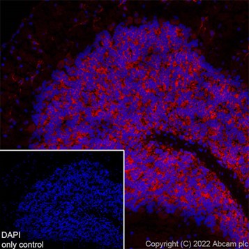 Immunohistochemistry (Frozen sections) - Alexa Fluor® 647 Anti-MAP2 antibody [EPR19691] - Neuronal Marker (AB225315), expandable thumbnail