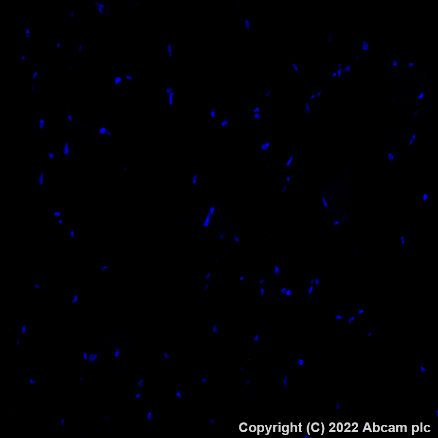 Immunohistochemistry (Formalin/PFA-fixed paraffin-embedded sections) - Alexa Fluor® 647 Anti-MARCO antibody [EPR22944-64] (AB307530), expandable thumbnail