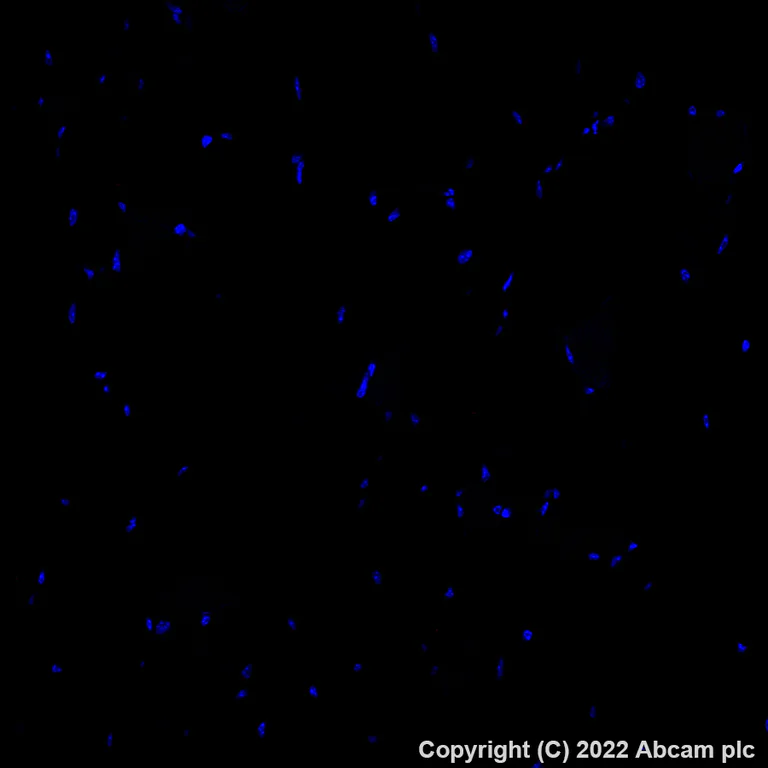 Immunohistochemistry (Formalin/PFA-fixed paraffin-embedded sections) - Alexa Fluor® 647 Anti-MARCO antibody [EPR22944-64] (AB307530)