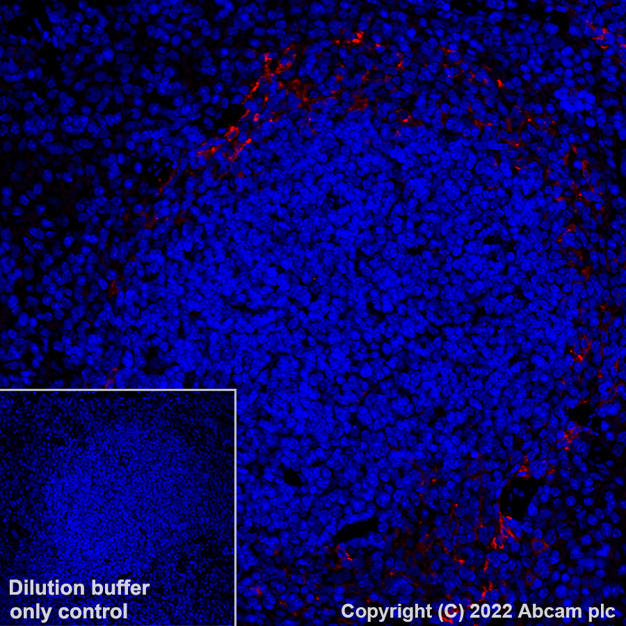 Immunohistochemistry (Formalin/PFA-fixed paraffin-embedded sections) - Alexa Fluor® 647 Anti-MARCO antibody [EPR22944-64] (AB307530), expandable thumbnail