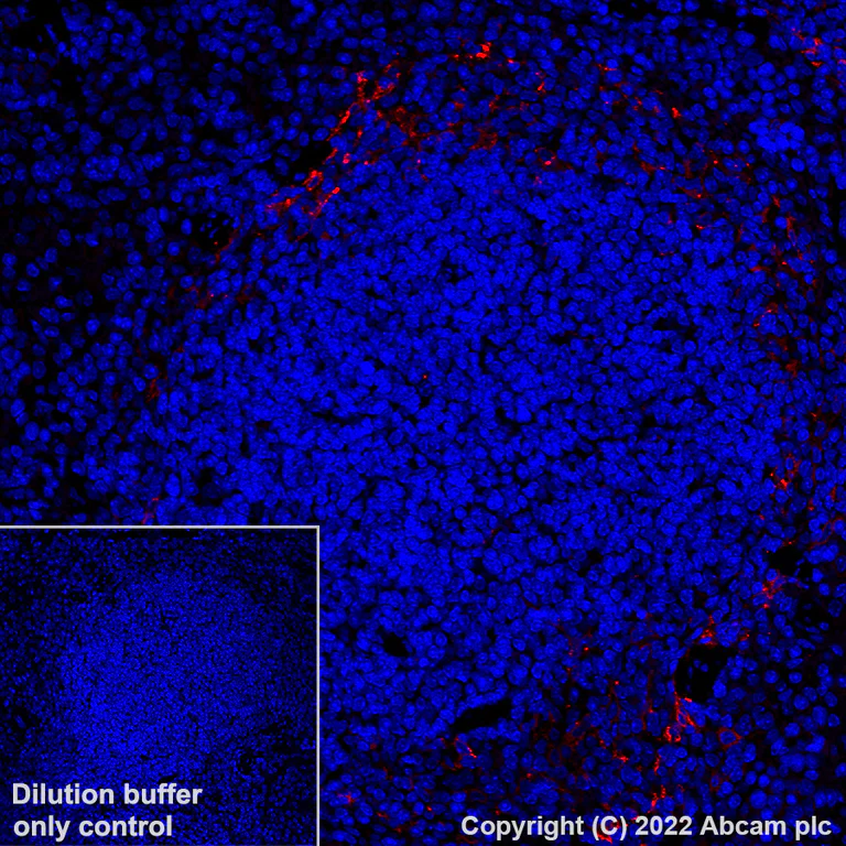 Immunohistochemistry (Formalin/PFA-fixed paraffin-embedded sections) - Alexa Fluor® 647 Anti-MARCO antibody [EPR22944-64] (AB307530)