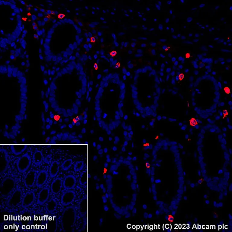 Immunohistochemistry (Formalin/PFA-fixed paraffin-embedded sections) - Alexa Fluor® 647 Anti-Mast Cell Tryptase antibody [EPR9522] (AB315263)