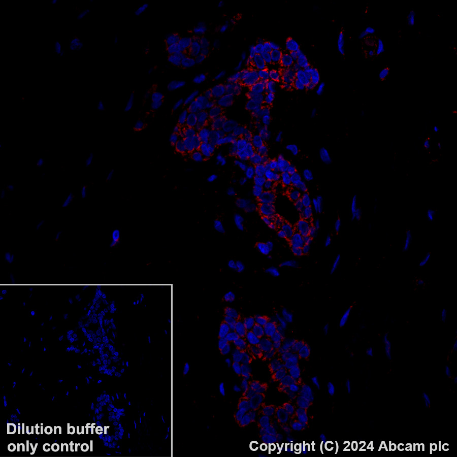 Immunohistochemistry (Formalin/PFA-fixed paraffin-embedded sections) - Alexa Fluor® 647 Anti-MAVS antibody [EPR26357-91] (AB317713), expandable thumbnail