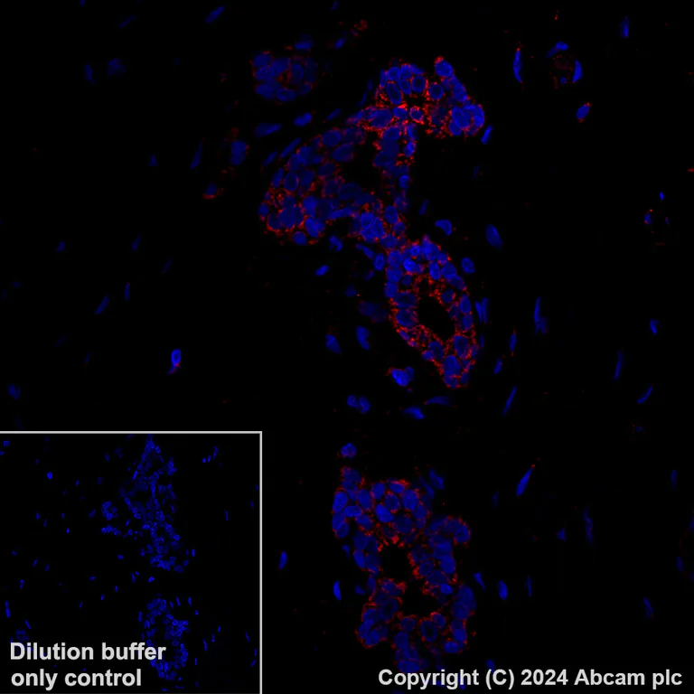 Immunohistochemistry (Formalin/PFA-fixed paraffin-embedded sections) - Alexa Fluor® 647 Anti-MAVS antibody [EPR26357-91] (AB317713)