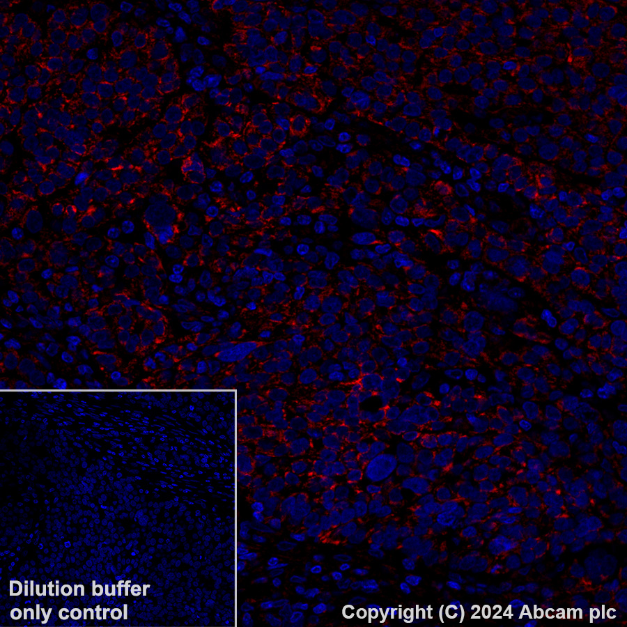 Immunohistochemistry (Formalin/PFA-fixed paraffin-embedded sections) - Alexa Fluor® 647 Anti-MAVS antibody [EPR26357-91] (AB317713), expandable thumbnail