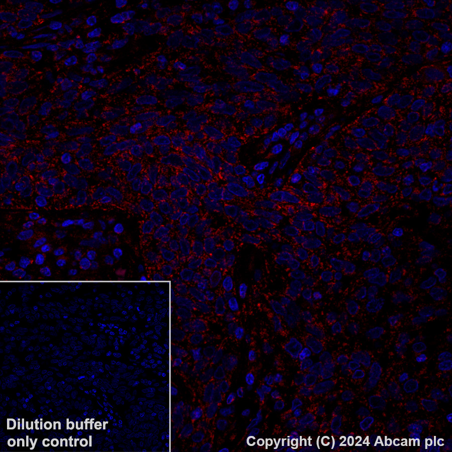 Immunohistochemistry (Formalin/PFA-fixed paraffin-embedded sections) - Alexa Fluor® 647 Anti-MAVS antibody [EPR26357-91] (AB317713), expandable thumbnail