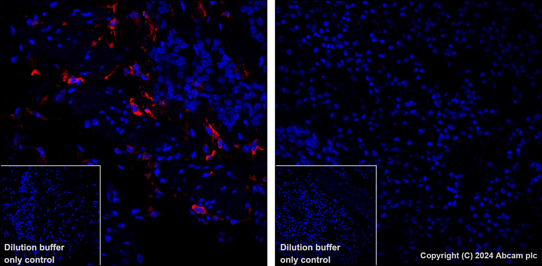 Immunohistochemistry (Formalin/PFA-fixed paraffin-embedded sections) - Alexa Fluor® 647 Anti-MCP1 antibody [EPR27464-89] (AB317532), expandable thumbnail