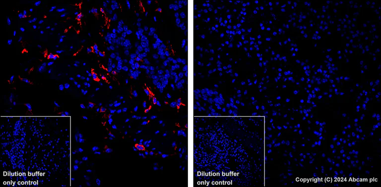 Immunohistochemistry (Formalin/PFA-fixed paraffin-embedded sections) - Alexa Fluor® 647 Anti-MCP1 antibody [EPR27464-89] (AB317532)