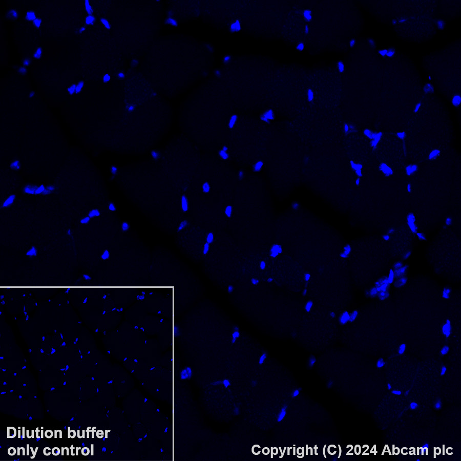 Immunohistochemistry (Formalin/PFA-fixed paraffin-embedded sections) - Alexa Fluor® 647 Anti-MCP1 antibody [EPR27464-89] (AB317532), expandable thumbnail