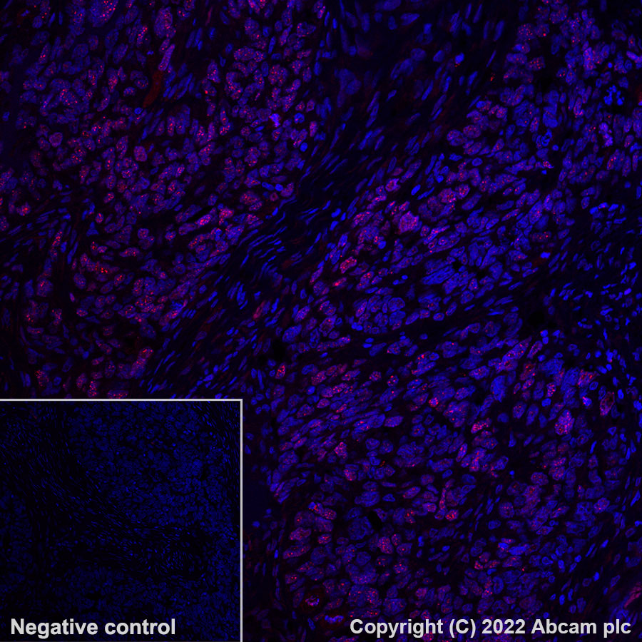 Immunohistochemistry (Formalin/PFA-fixed paraffin-embedded sections) - Alexa Fluor® 647 Anti-MDC1 antibody [EPR24360-116] (AB300735), expandable thumbnail