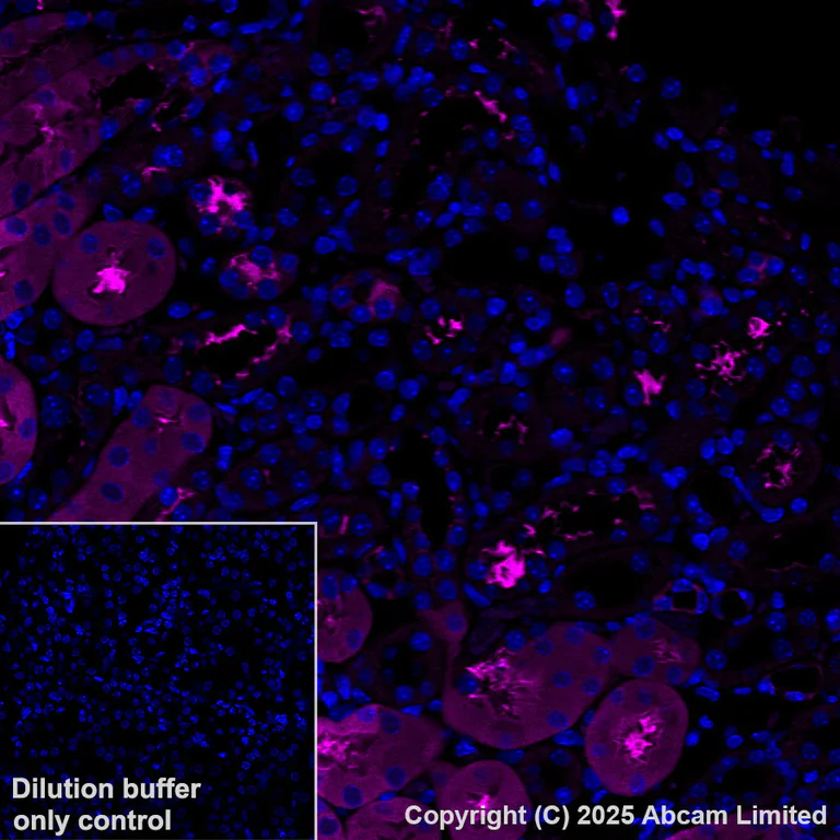 Immunohistochemistry (Formalin/PFA-fixed paraffin-embedded sections) - Alexa Fluor® 647 Anti-ME1 antibody [EPR28891-30] (AB325115)