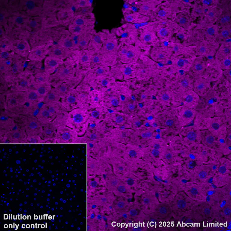 Immunohistochemistry (Formalin/PFA-fixed paraffin-embedded sections) - Alexa Fluor® 647 Anti-ME1 antibody [EPR28891-30] (AB325115)