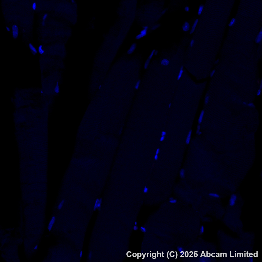 Immunohistochemistry (Formalin/PFA-fixed paraffin-embedded sections) - Alexa Fluor® 647 Anti-MelanA antibody [EPR20380] (AB225500)
