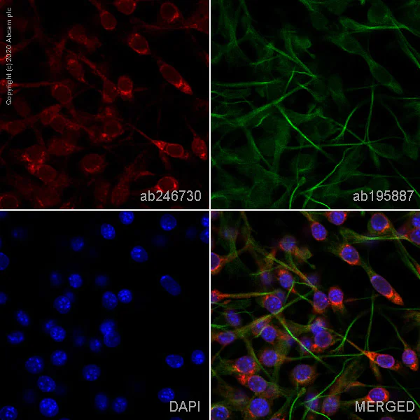 Immunocytochemistry/ Immunofluorescence - Alexa Fluor® 647 Anti-Melanoma gp100 antibody [EP4863(2)] (AB246730)