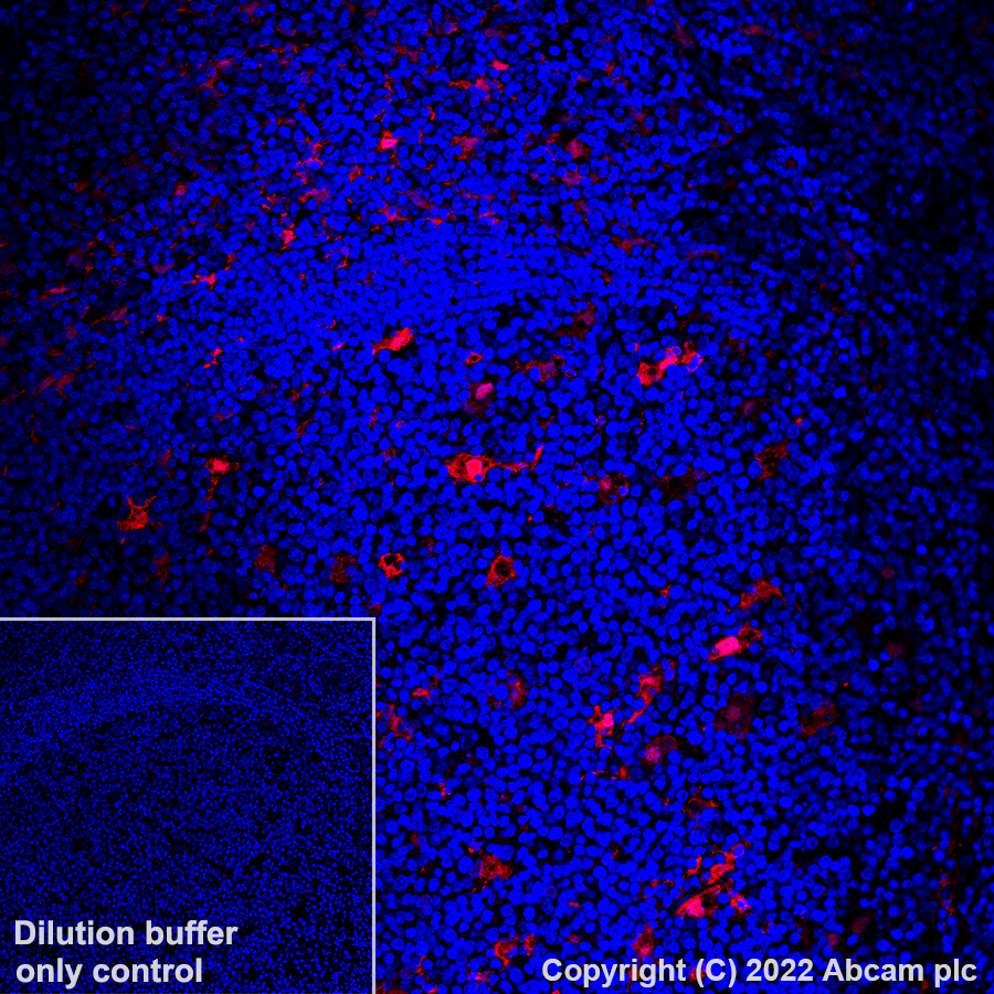 Immunohistochemistry (Formalin/PFA-fixed paraffin-embedded sections) - Alexa Fluor® 647 Anti-MERTK antibody [Y323] (AB305049), expandable thumbnail