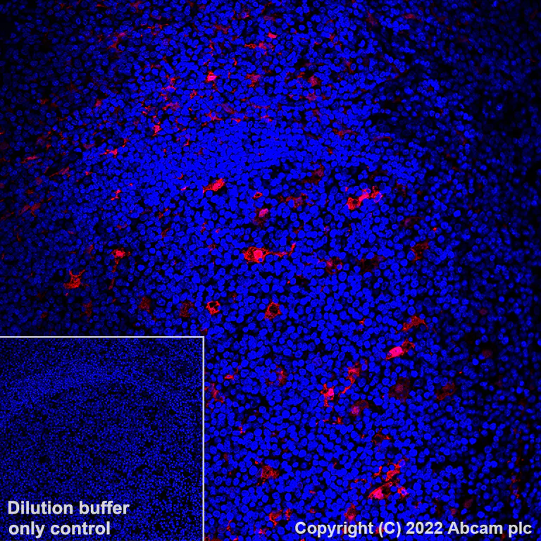 Immunohistochemistry (Formalin/PFA-fixed paraffin-embedded sections) - Alexa Fluor® 647 Anti-MERTK antibody [Y323] (AB305049)