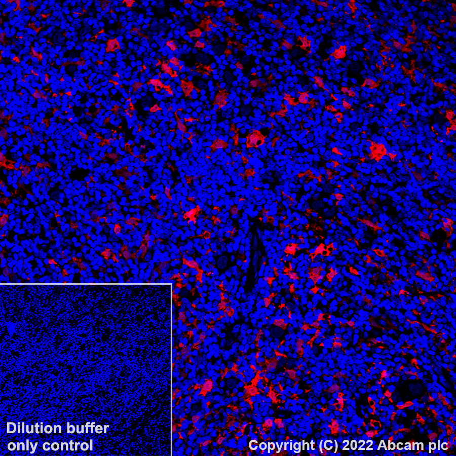 Immunohistochemistry (Formalin/PFA-fixed paraffin-embedded sections) - Alexa Fluor® 647 Anti-MERTK antibody [Y323] (AB305049), expandable thumbnail