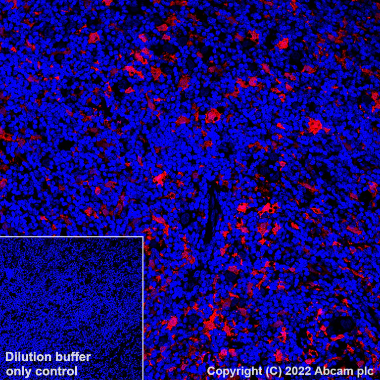 Immunohistochemistry (Formalin/PFA-fixed paraffin-embedded sections) - Alexa Fluor® 647 Anti-MERTK antibody [Y323] (AB305049)