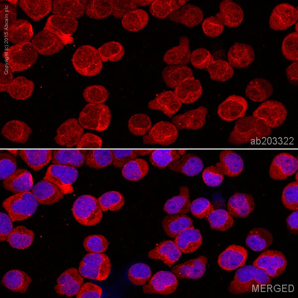 Immunocytochemistry/ Immunofluorescence - Alexa Fluor® 647 Anti-MHC Class II beta antibody [EPR11227] (AB203323)