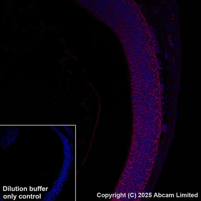 Immunohistochemistry (Formalin/PFA-fixed paraffin-embedded sections) - Alexa Fluor® 647 Anti-Midkine antibody [EPR29075-34] (AB323764)