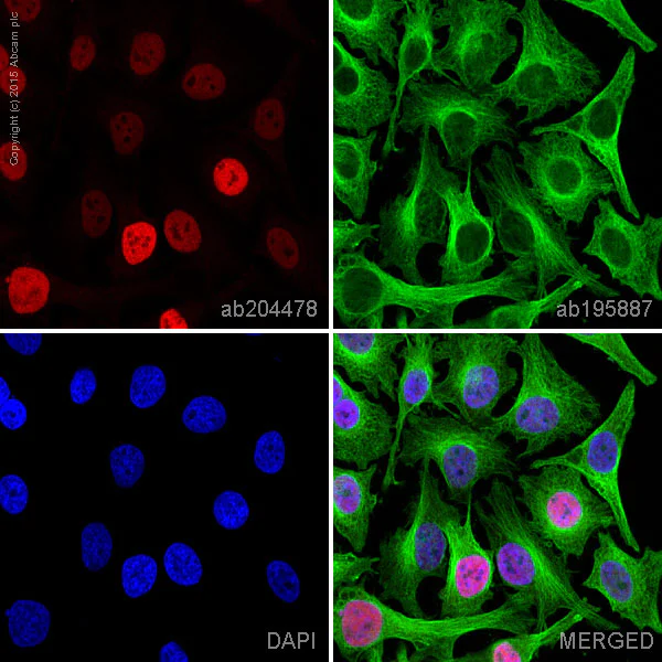 Immunocytochemistry/ Immunofluorescence - Alexa Fluor® 647 Anti-MKLP1 antibody [EPR10879] (AB204478)