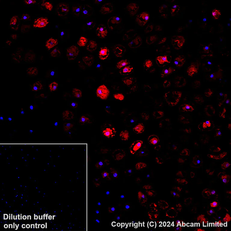 Immunohistochemistry (Formalin/PFA-fixed paraffin-embedded sections) - Alexa Fluor® 647 Anti-MMP13 antibody [EPR25858-87] (AB320117)