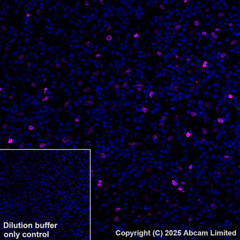 Immunohistochemistry (Formalin/PFA-fixed paraffin-embedded sections) - Alexa Fluor® 647 Anti-MNDA antibody [EPR28267-44] (AB324064)